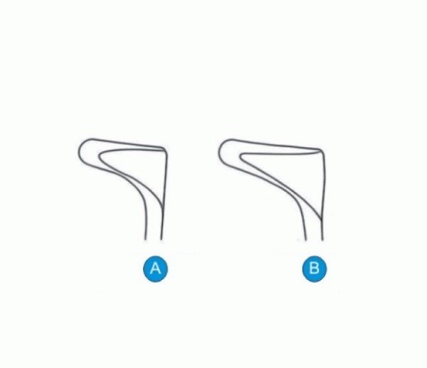 Tieck-halle-view-600x852 Tieck-Halle Nasal Speculum, 13.5cm - Image 2