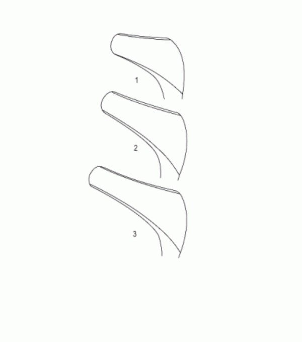 hartmann-halle-view-600x852 Hartmann-Halle Nasal Speculum, 15cm - Image 2